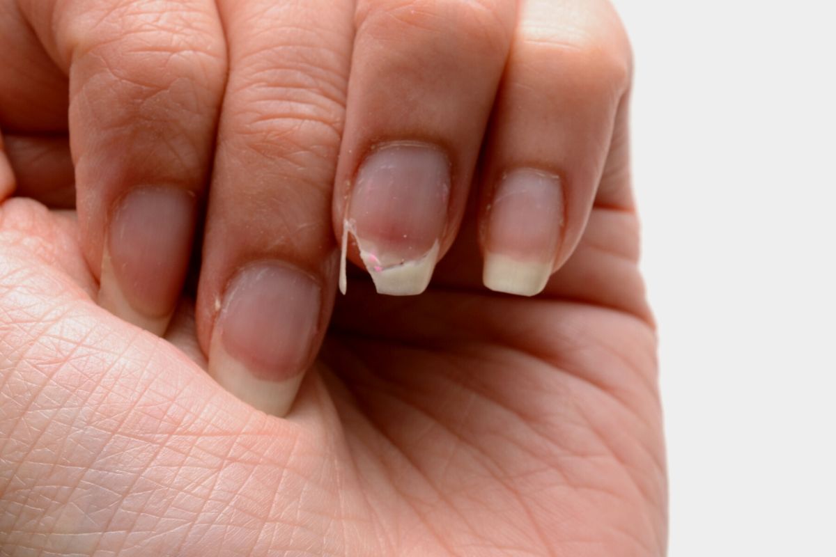 Por que as unhas ficam amarelas depois de tirar o esmalte? — Foto: Canva