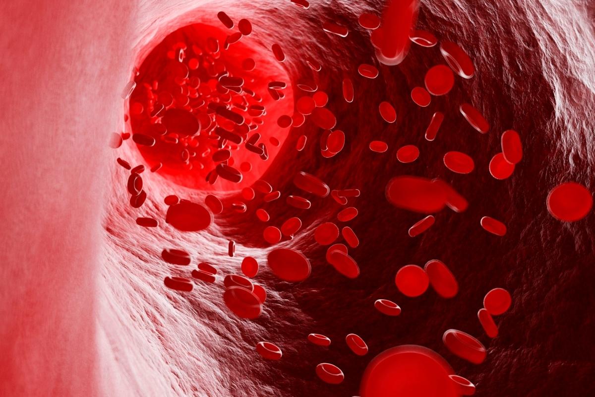 Qual suco ajuda no combate da anemia? Esse auxilia no cansaço e fraqueza! Reprodução: Canva 