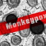Varíola dos Macacos - Reprodução Pixabay